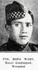 Private Ropa (Kopa) Waru, Maori Contingent, wounded at the Dardanelles 8 Aug 1915